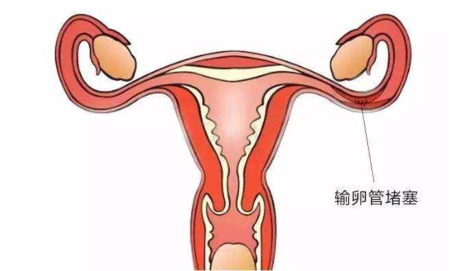 温州合法代怀网 2022年单身女性在温州做试管婴儿能用供精吗? ‘胎囊数据看男